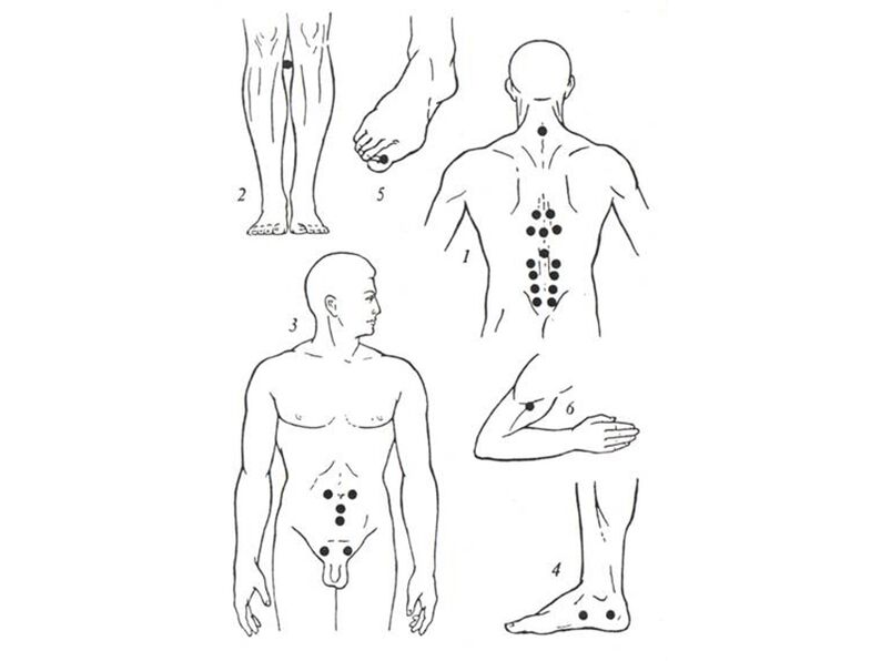 Akupunkture Massage